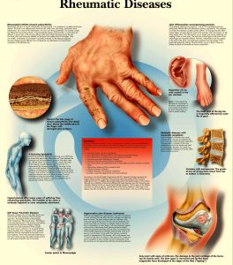Rheumatic Diseases 