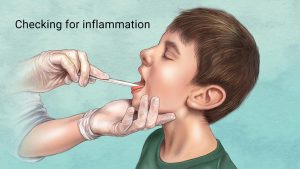 Tonsillitis, Pharyngitis, Diphtheria, and Other Throat Diseases